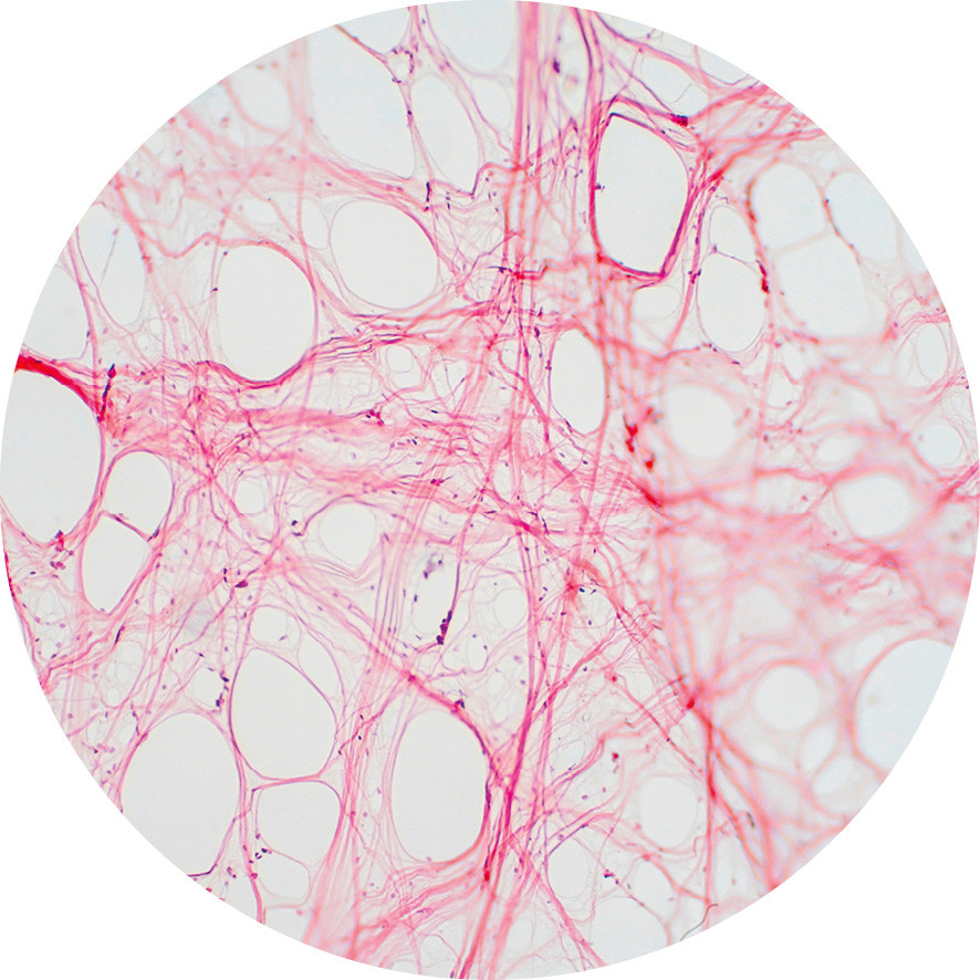La «toile d’araignée» des fascias sous le microscope | © Shutterstock